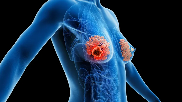 乳がんのホルモン療法とは？効果・種類・副作用をやさしく解説