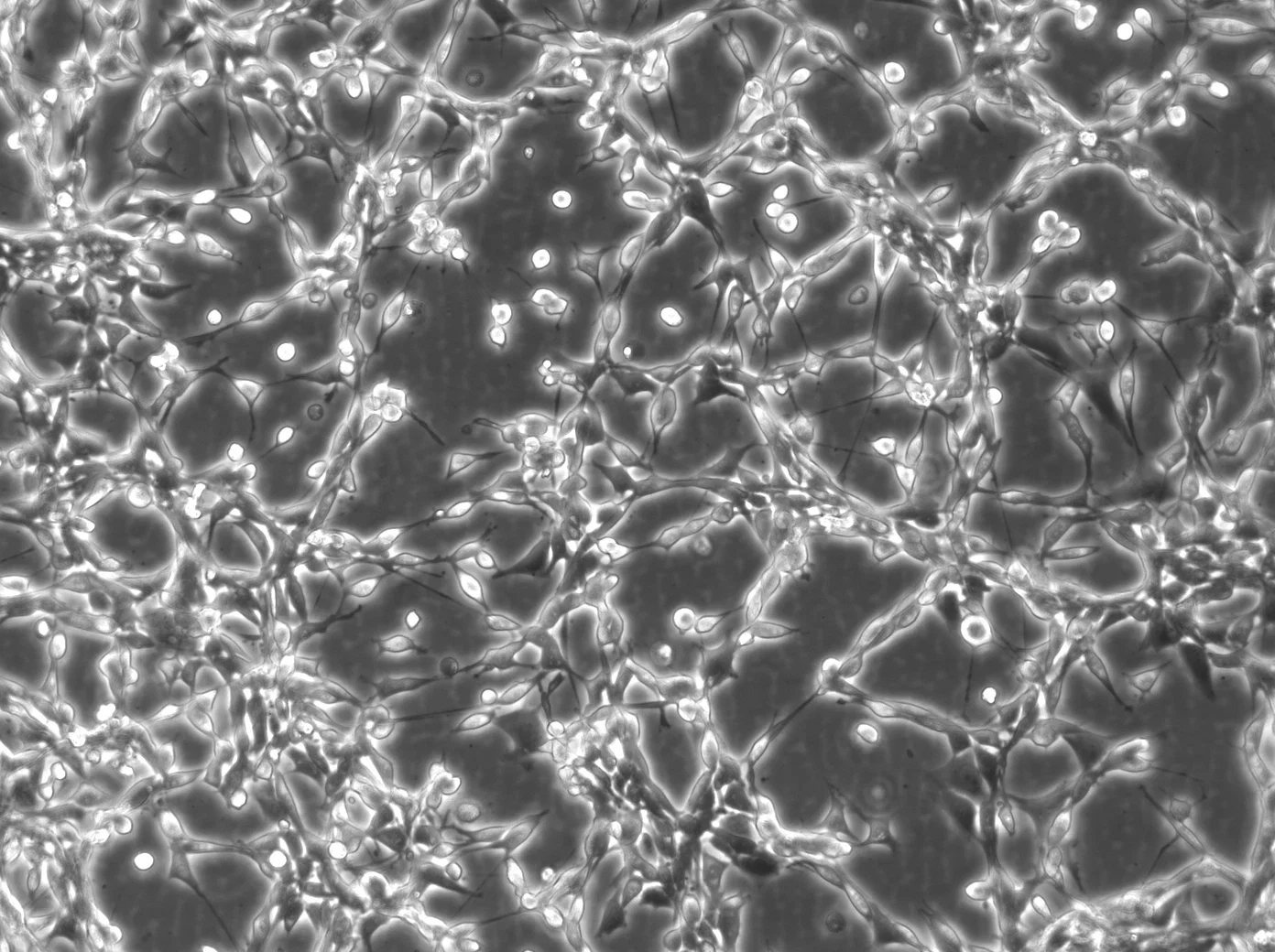 c26 結腸がん細胞とは？特徴・症状・治療法・最新研究をわかりやすく解説